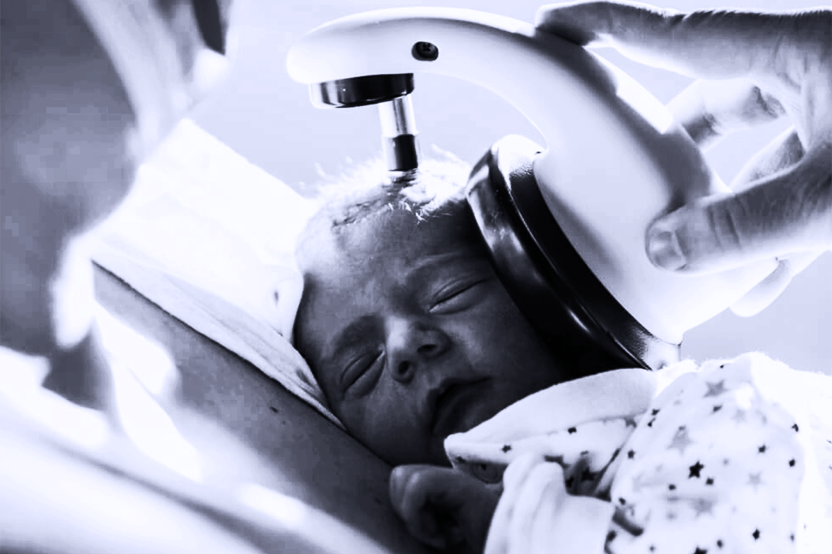 iHearBetterNow-Auditory Brainstem Response (ABR) iHearBetterNow-Auditory Brainstem Response (ABR)